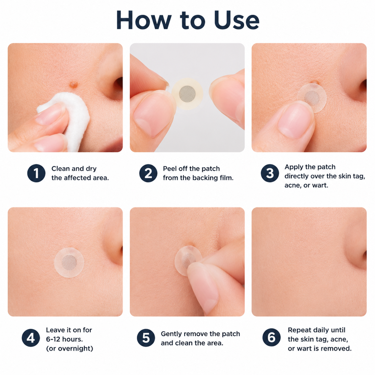 ✨PuraCure®2-in-1 Microneedle & Hydrocolloid Patch🍀| Removes Raised Moles, Acne, Flat Warts & Skin Tags | Helps Improve Wrinkles, Scars & Blemishes | Invisible Patches for Face & Body