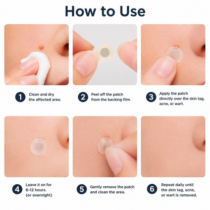 ✨PuraCure®2-in-1 Microneedle & Hydrocolloid Patch🍀| Removes Raised Moles, Acne, Flat Warts & Skin Tags | Helps Improve Wrinkles, Scars & Blemishes | Invisible Patches for Face & Body