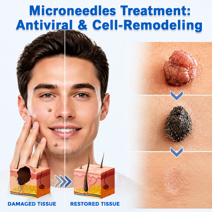 ✨PuraCure®2-in-1 Microneedle & Hydrocolloid Patch🍀| Removes Raised Moles, Acne, Flat Warts & Skin Tags | Helps Improve Wrinkles, Scars & Blemishes | Invisible Patches for Face & Body