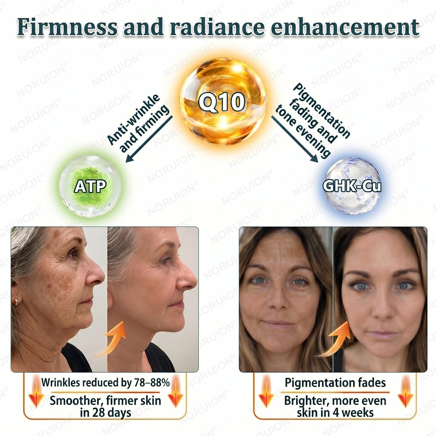 🍈NORUION®  Q10 x Botanical Nano Exosome Advanced Anti-Wrinkle Cream