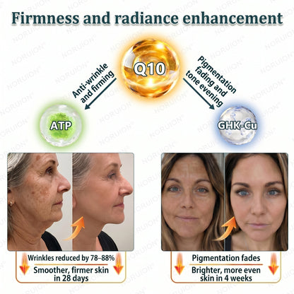 🍈NORUION®  Q10 x Botanical Nano Exosome Advanced Anti-Wrinkle Cream