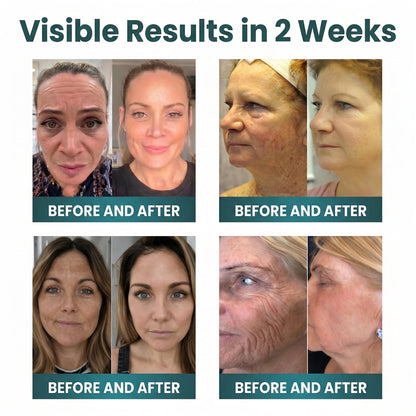 🍈NORUION®  Q10 x Botanical Nano Exosome Advanced Anti-Wrinkle Cream